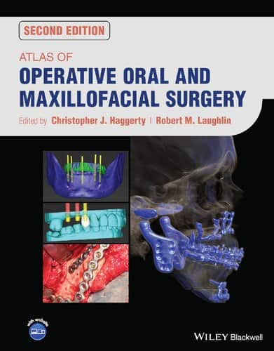 Atlas of Operative Oral and Maxillofacial Surgery (2nd Edition) - eBook