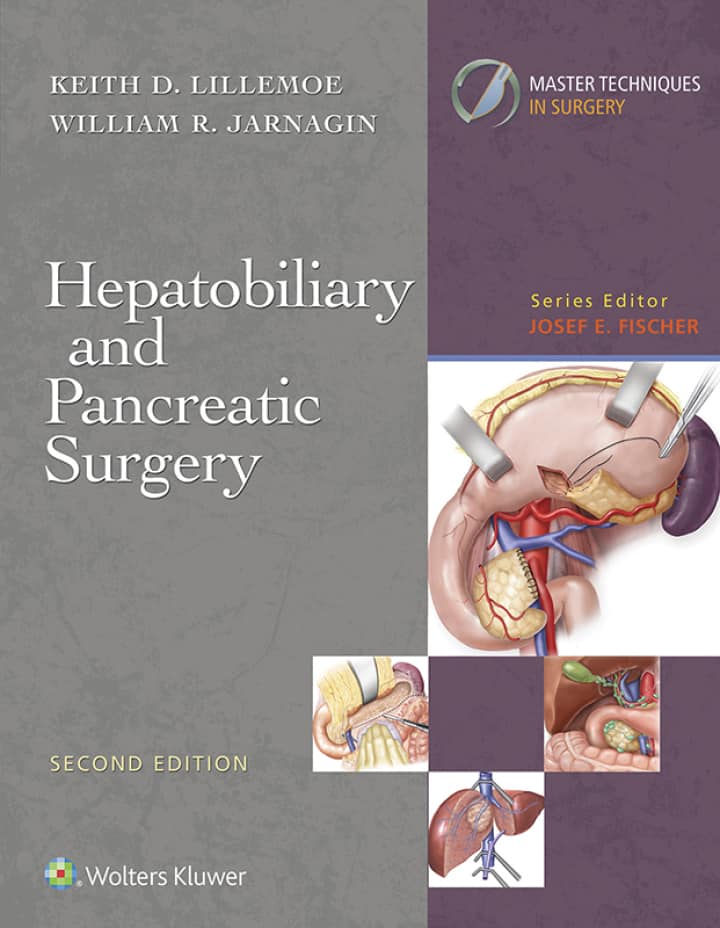 Master Techniques in Surgery: Hepatobiliary and Pancreatic Surgery (2nd Edition) - eBook